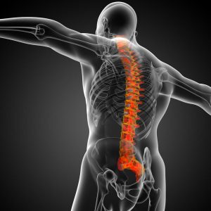 FDA Trial on P-15 published in the Spine Journal